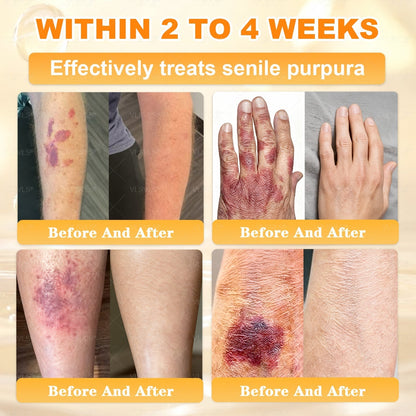 💐 Cavebit® Bee Venom Cream – Fast Skin Repair | Made in USA | 80% OFF!