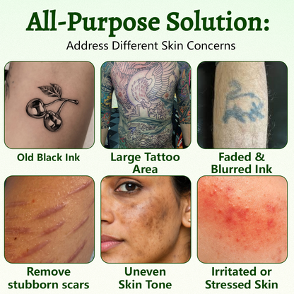 Coredew® PureAlgae Ink Removal Support Spray 🌿 — Say Goodbye to Old Tattoo Pigment 💚, Fade Stubborn Ink ✨, Repair & Smooth Treated Skin 💧, Non-Laser ✅, Try It Now! 🔥