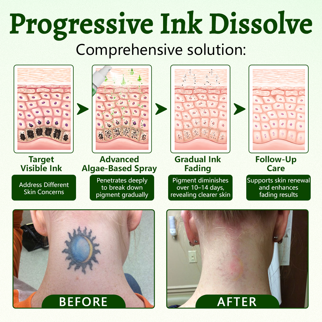 Coredew® PureAlgae Ink Removal Support Spray 🌿 — Say Goodbye to Old Tattoo Pigment 💚, Fade Stubborn Ink ✨, Repair & Smooth Treated Skin 💧, Non-Laser ✅, Try It Now! 🔥