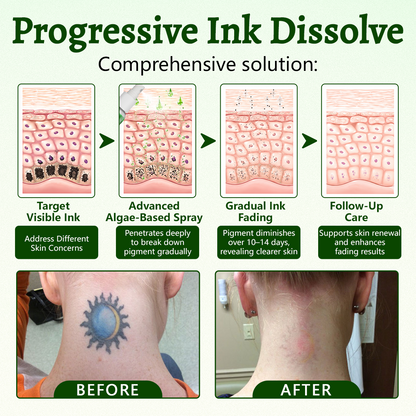 Coredew® PureAlgae Ink Removal Support Spray 🌿 — Say Goodbye to Old Tattoo Pigment 💚, Fade Stubborn Ink ✨, Repair & Smooth Treated Skin 💧, Non-Laser ✅, Try It Now! 🔥