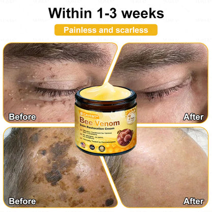 💐 Cavebit® Bee Venom Cream – Fast Skin Repair | Made in USA | 80% OFF!