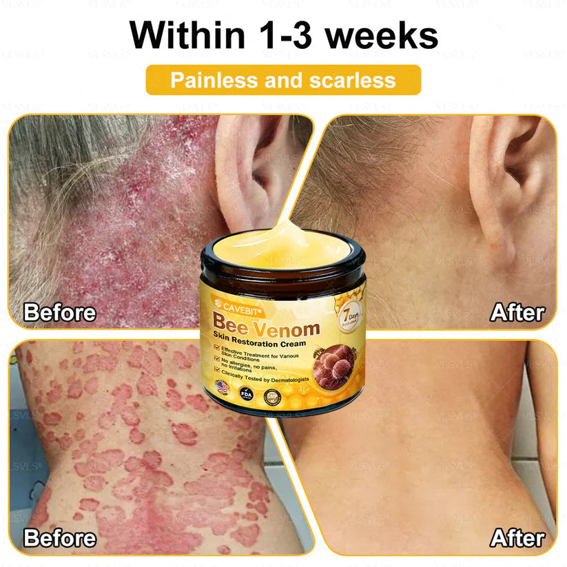 💐 Cavebit® Bee Venom Cream – Fast Skin Repair | Made in USA | 80% OFF!