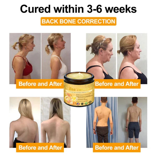 Mayo Clinic recommends👨‍⚕️: Bee Venom Advanced Joint and Bone Healing Cream
