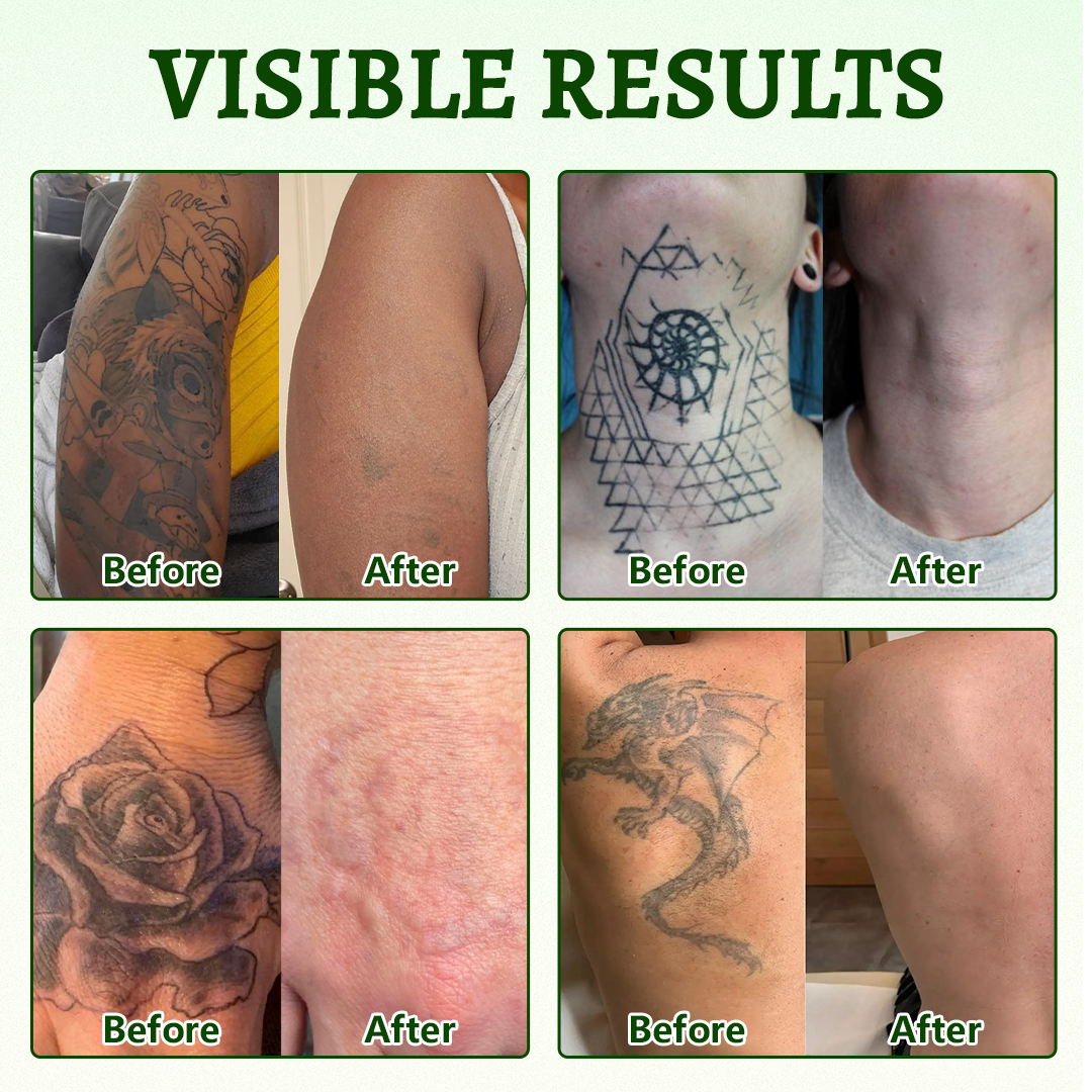 Coredew® PureAlgae Ink Removal Support Spray 🌿 — Say Goodbye to Old Tattoo Pigment 💚, Fade Stubborn Ink ✨, Repair & Smooth Treated Skin 💧, Non-Laser ✅, Try It Now! 🔥