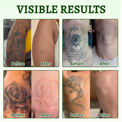 Coredew® PureAlgae Ink Removal Support Spray 🌿 — Say Goodbye to Old Tattoo Pigment 💚, Fade Stubborn Ink ✨, Repair & Smooth Treated Skin 💧, Non-Laser ✅, Try It Now! 🔥