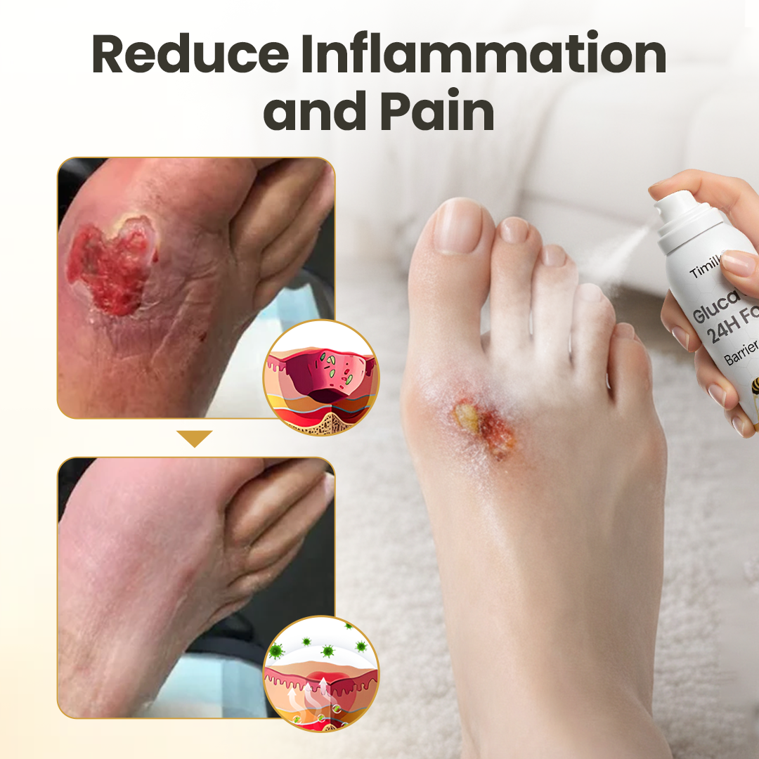 Acezozla® GlucaVeil 24H Foot Barrier Spray